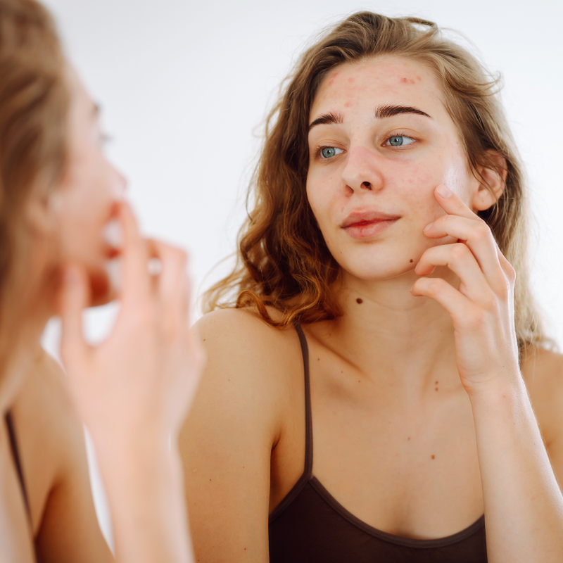 How to recognise a damaged skin barrier and what to actually do about it?